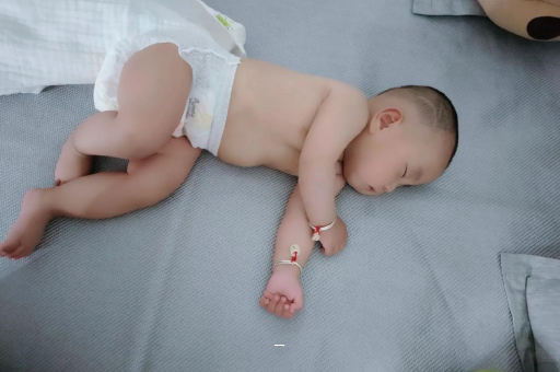 微山宝宝脸上有白色斑块
